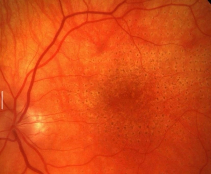 Офтальмологическая служба Курганского областного госпиталя для ветеранов войн продолжает совершенствоваться