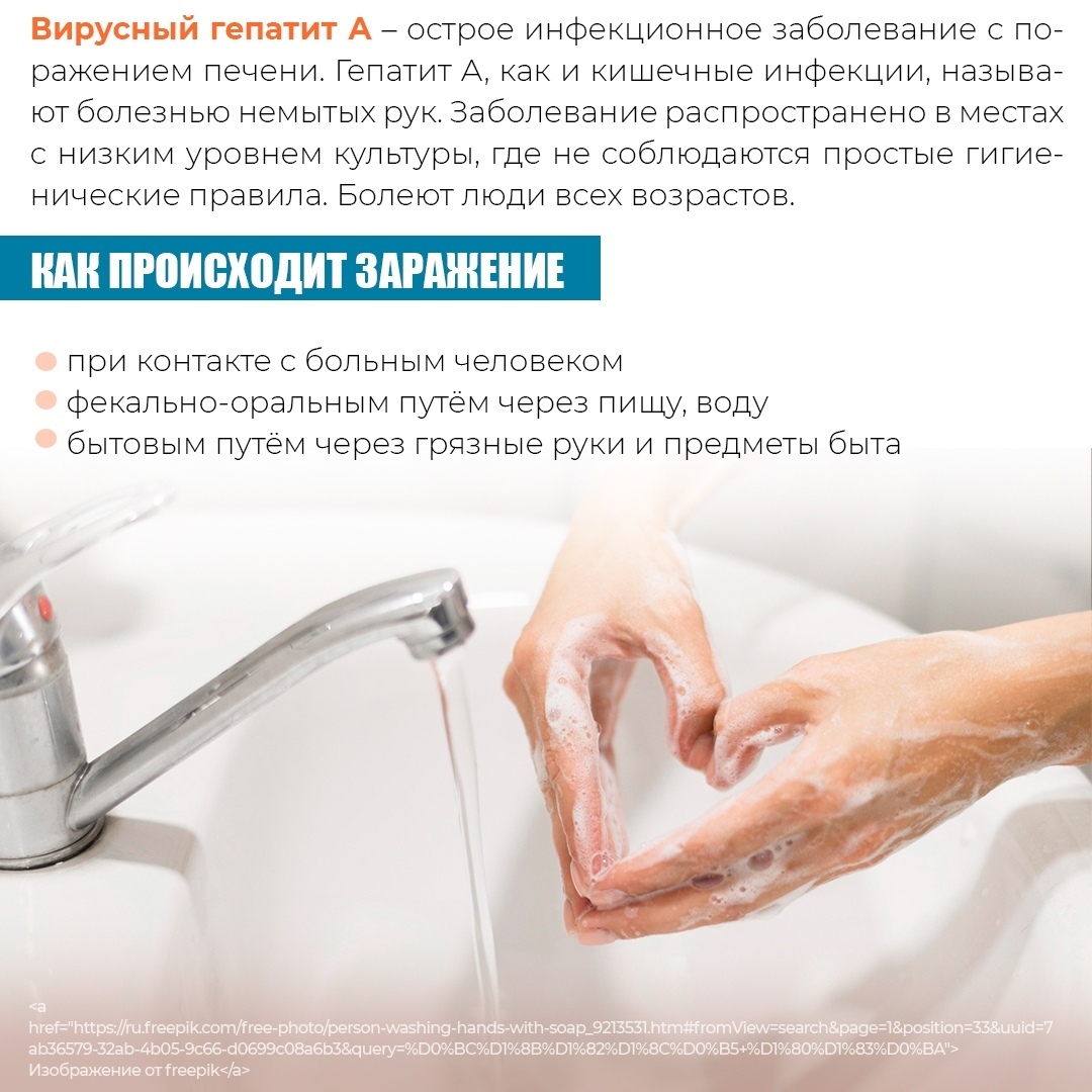  Вирусный гепатит А – острое инфекционное заболевание с поражением печени