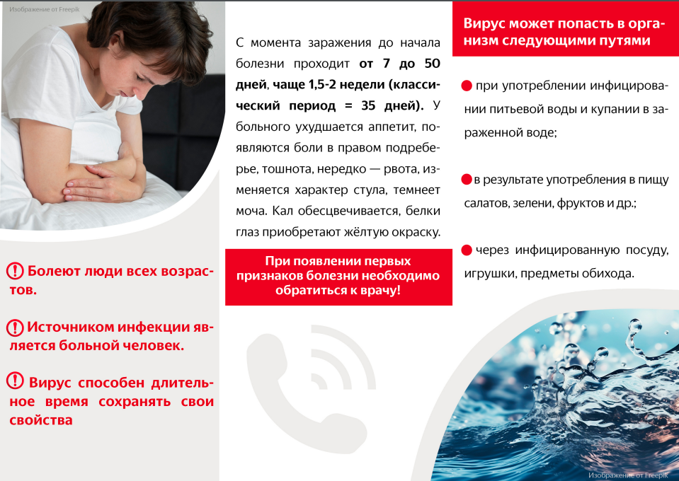 Вирусный гепатит А - это острое инфекционное заболевание с поражением печени  